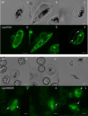 Budding pouches and associated bubbles: 3D visualization of exo-membrane structures in plasmodium falciparum gametocytes